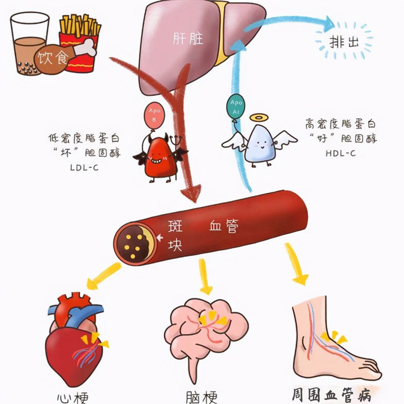血脂四項的重要性.jpg 血脂四項的重要性.jpg